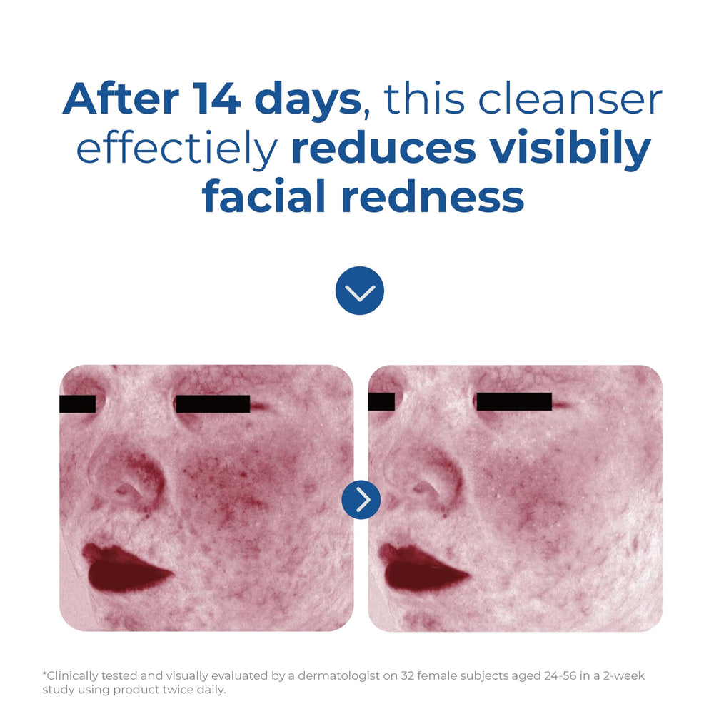 EltaMD cleanser on bathroom vanity evoking calming skincare routine benefit