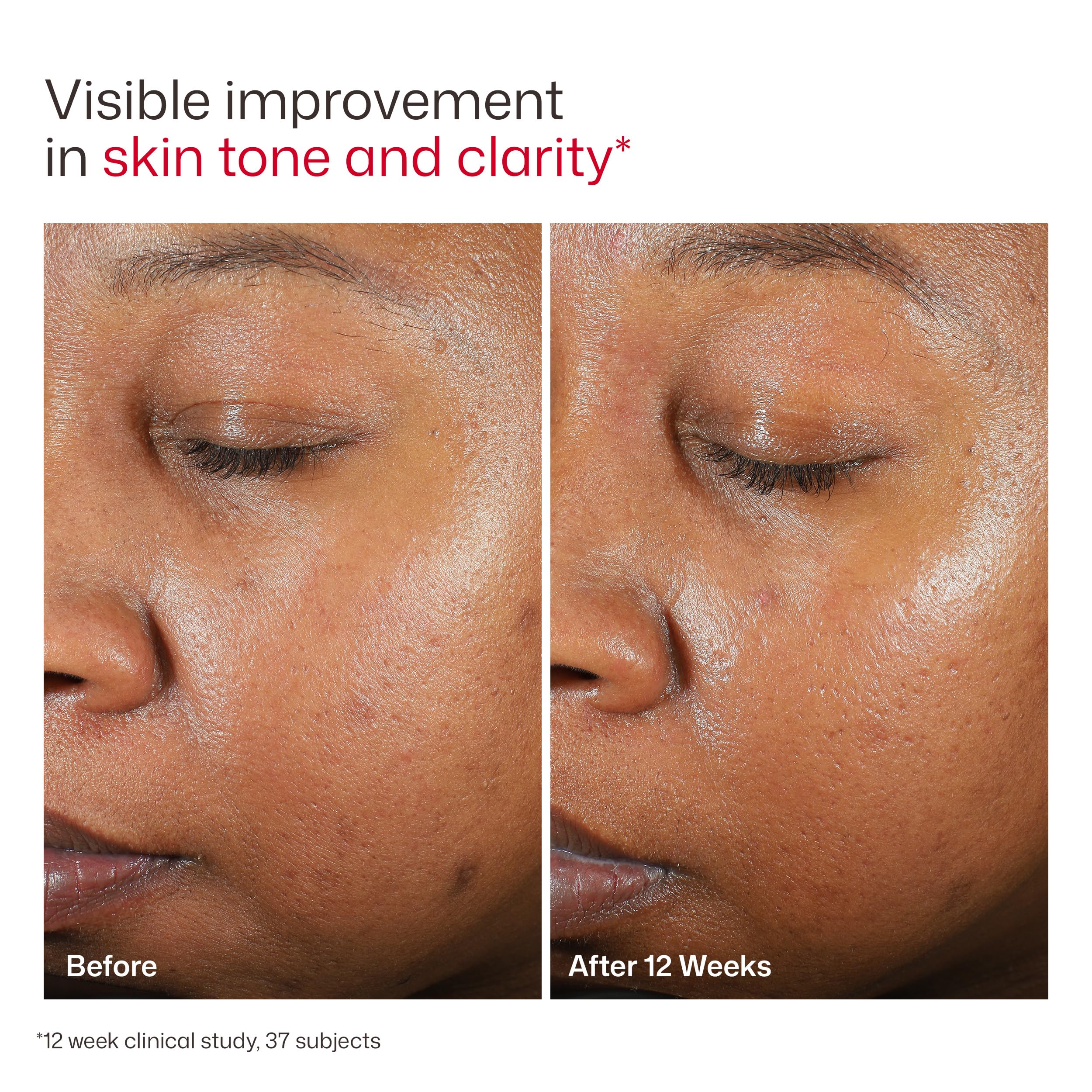 EltaMD product spread on hand showing non-greasy finish and hydrating hyaluronic benefit