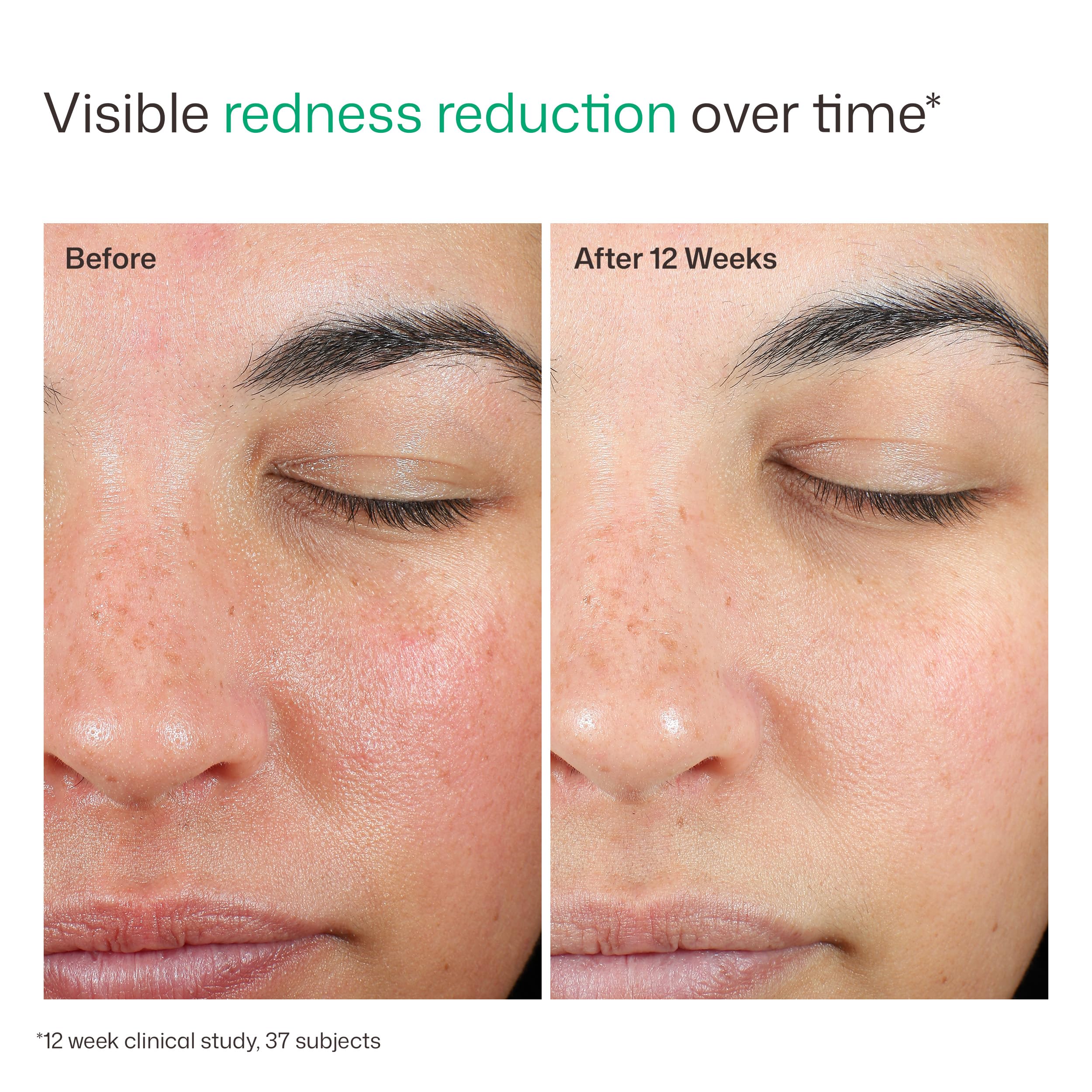 Model applying EltaMD under makeup to demonstrate smooth layering ability
