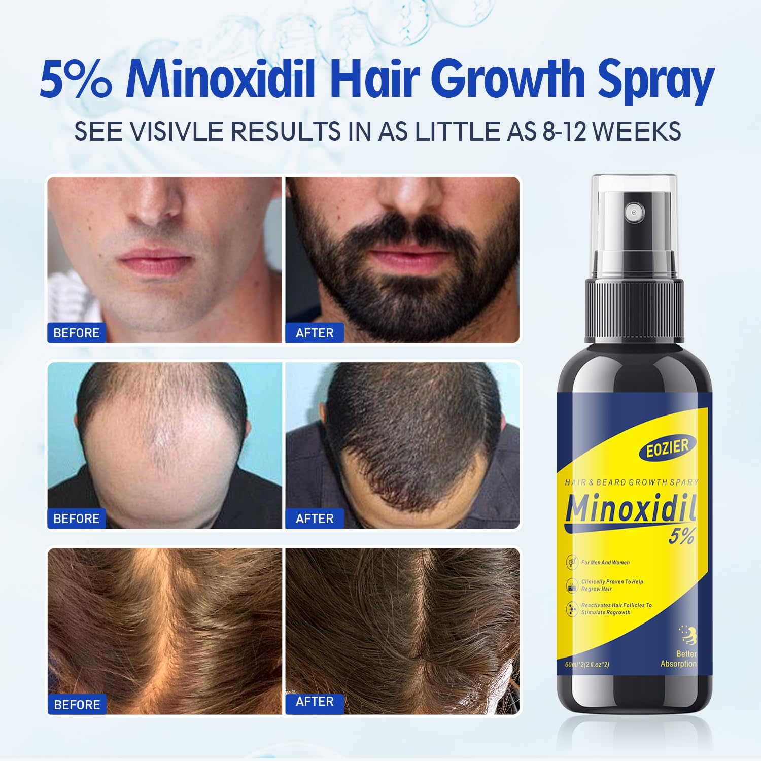 Eozier used on beard patch showing targeted facial hair coverage benefit