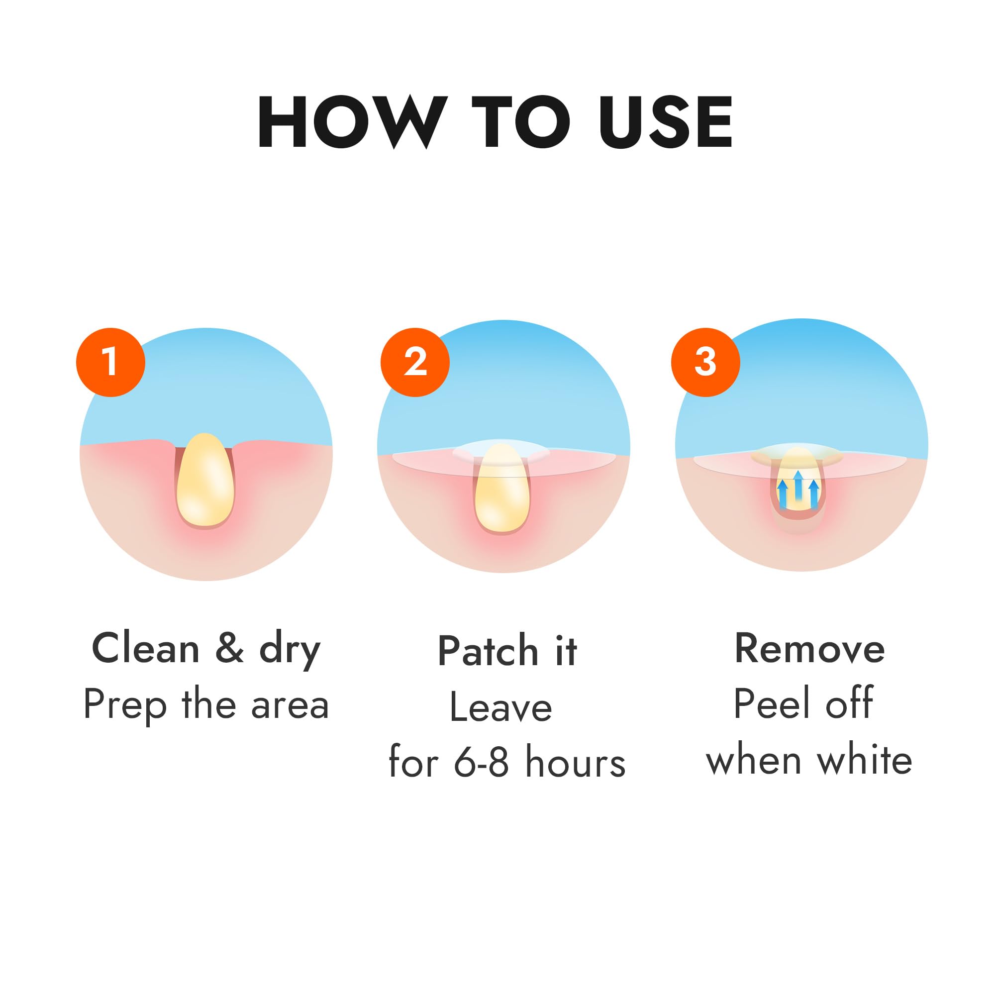 Epielle opened pack with multiple patches organized for convenient treatment