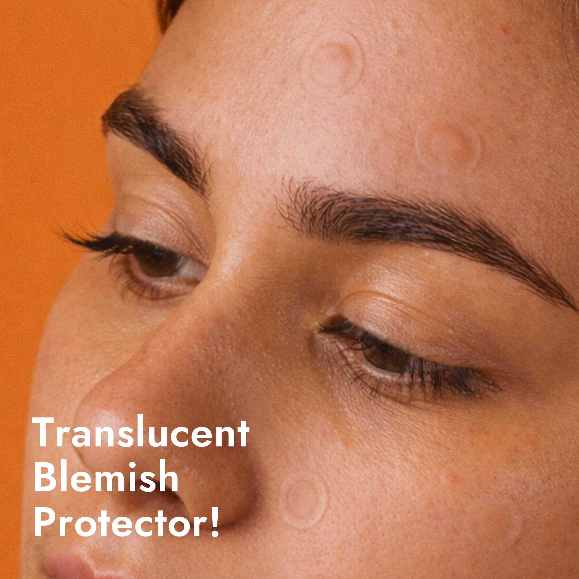 Epielle patch applied to a blemish on skin demonstrating protection and healing