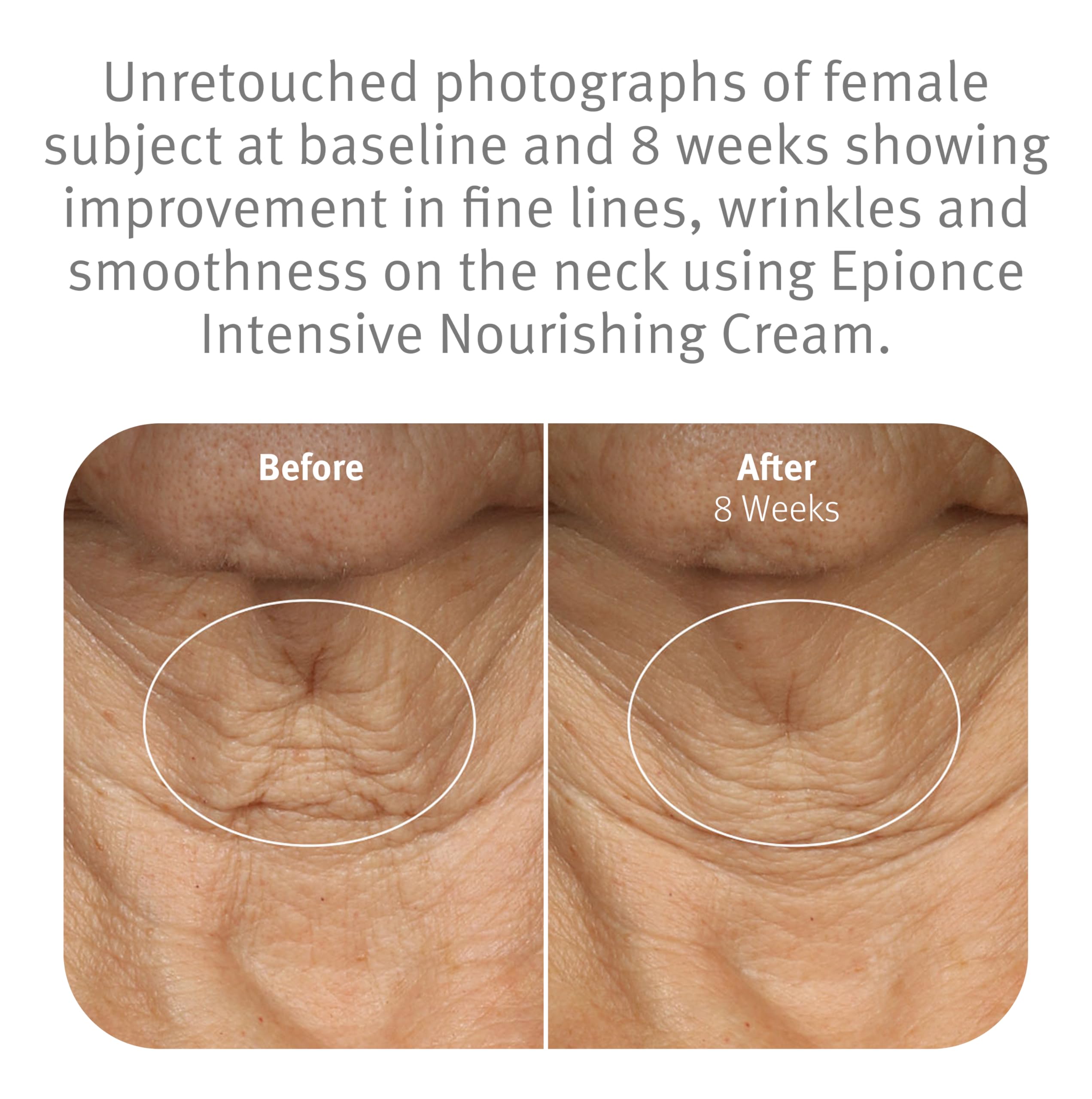 Hand applying Epionce cream to cheek demonstrating smooth application and hydration benefit