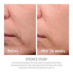Epionce lotion texture close-up demonstrating lightweight, fast-absorbing feel