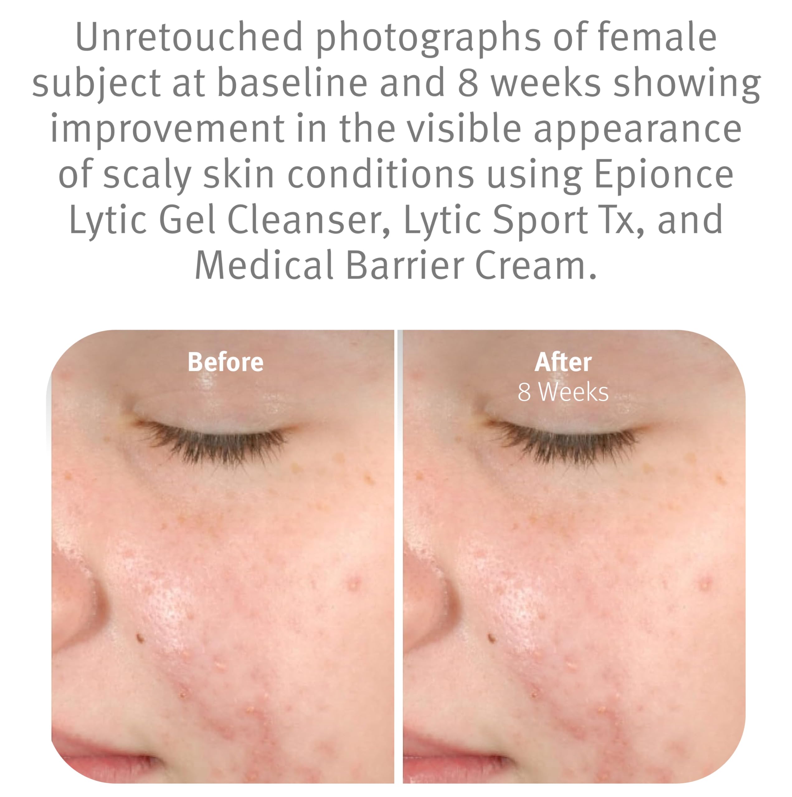 Epionce cleanser on hand being applied to show efficient makeup and oil removal