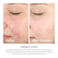 Epionce purifying toner spray mist demonstrating quick application and coverage