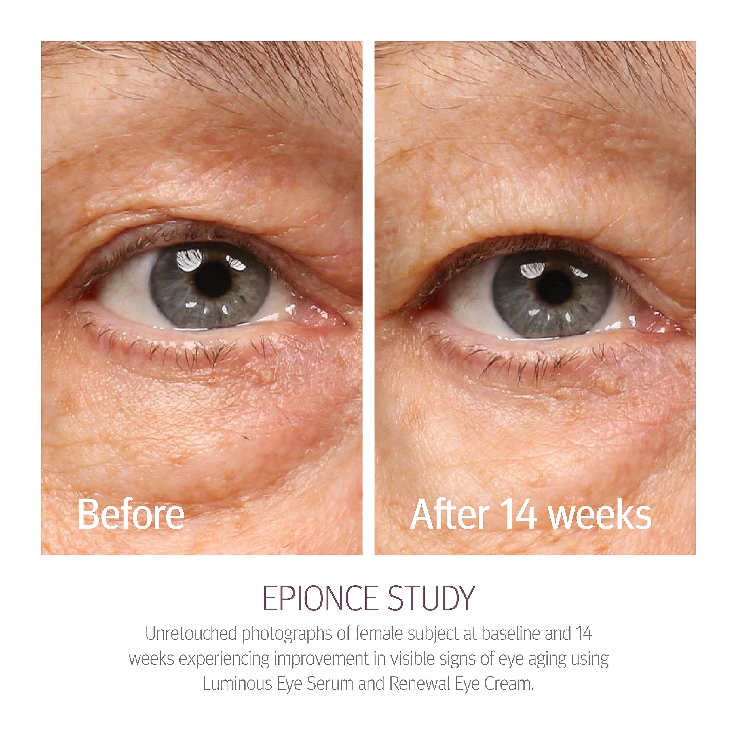 Epionce Renewal Eye Cream on fingertip ready for precise under-eye application