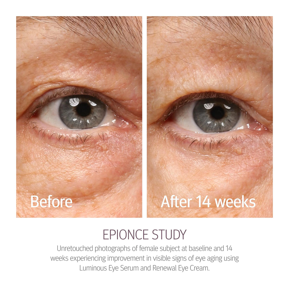 Epionce Renewal Eye Cream on fingertip ready for precise under-eye application