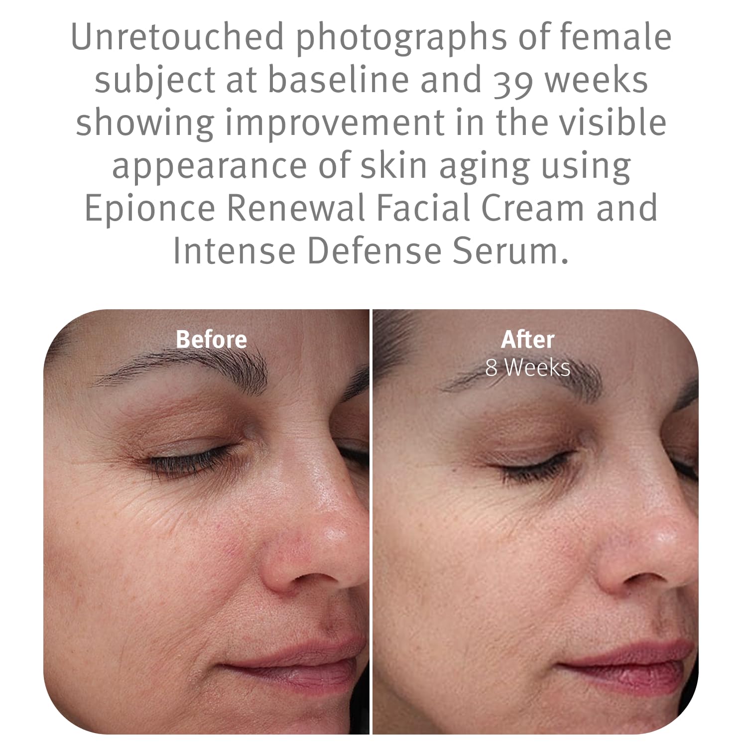 Applying Epionce Renewal Facial Cream on hand to show smooth spreadability and comfort