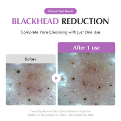 EQQUALBERRY purple rice ingredient display, antioxidant-rich benefit