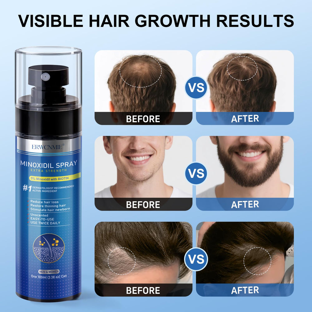 ERWCNMIE bottle label detail highlighting 5% minoxidil and supportive ingredients