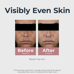 Eucerin serum texture on skin highlighting lightweight hydration benefit