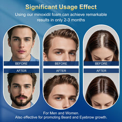 Exdeploy label and ingredients detail highlighting biotin and 5% minoxidil info