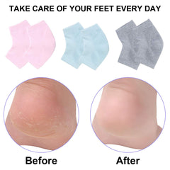 Exptolii worn on feet to show fit and daily-wear comfort benefit