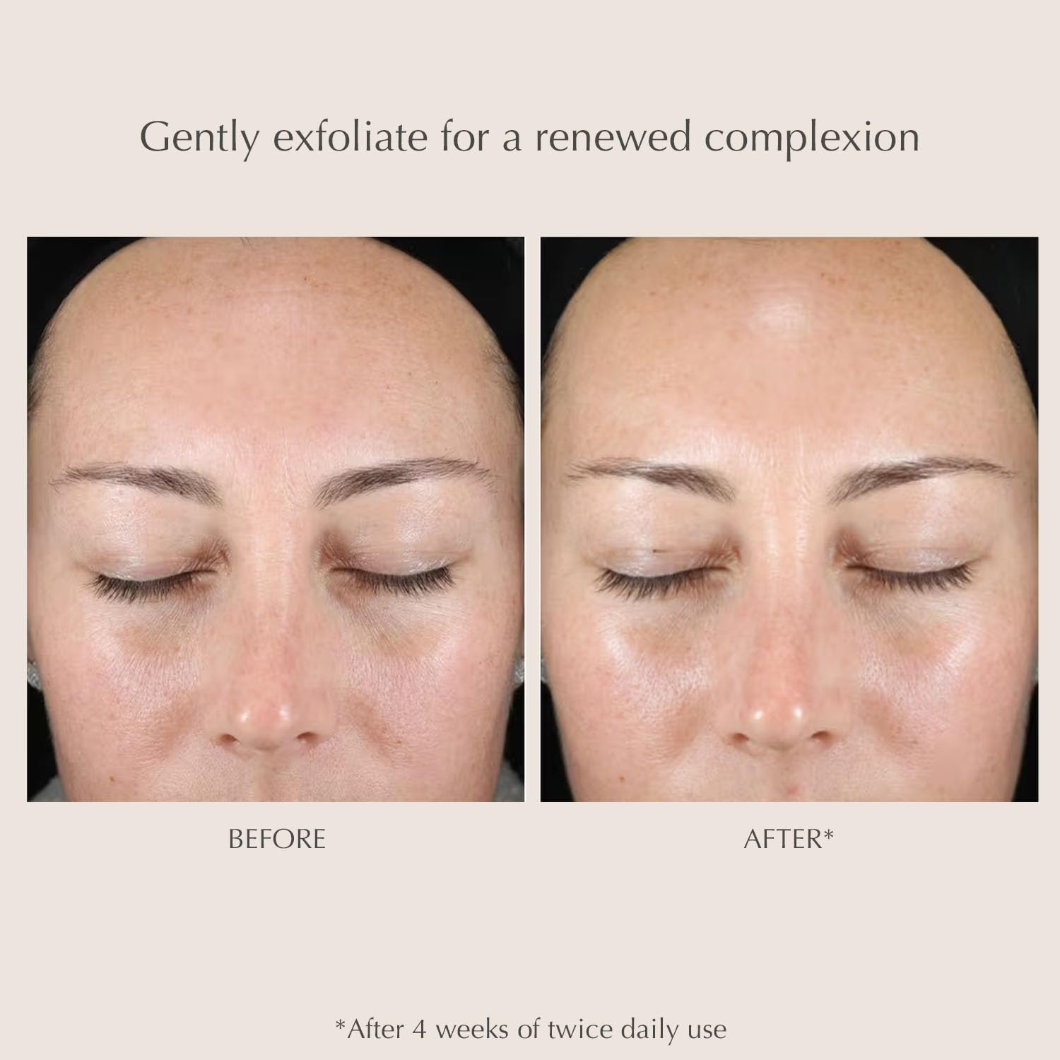 EXUVIANCE pad applied to cheek demonstrating gentle exfoliation benefit
