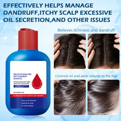 F FENG PEI scalp massage in use demonstrating targeted cleaning benefit
