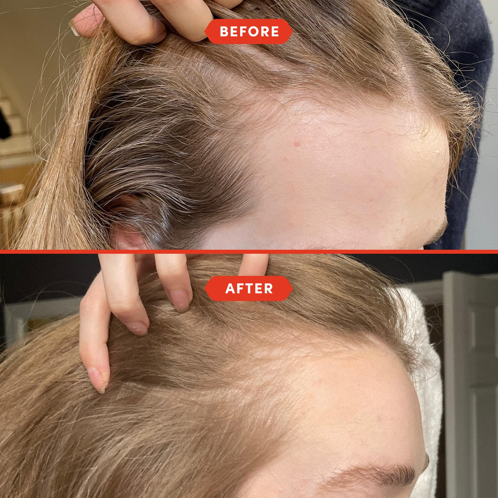 Fable & Mane with amla and castor visuals highlighting natural botanicals