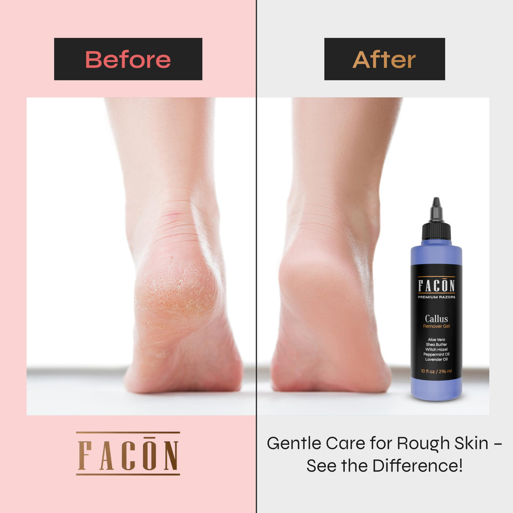 FACON gel texture on skin demonstrating smooth spread and softening effect