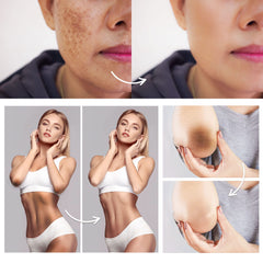 FAMIROSA being applied to underarm illustrating targeted care and softer skin