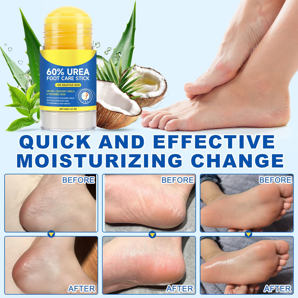 FANSHI ingredients display with urea and salicylic acid for exfoliation