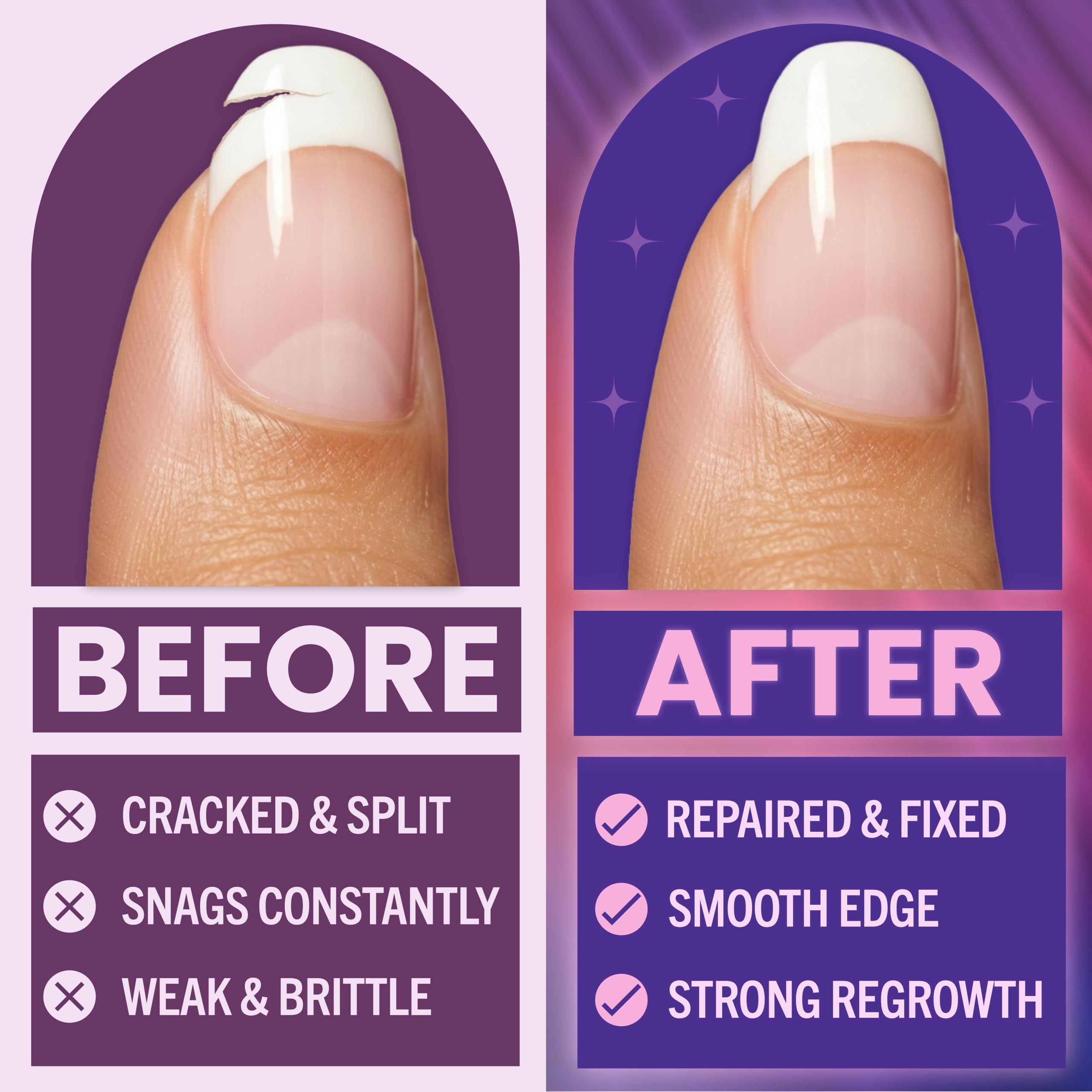 Finga-Nails repair glue nozzle detail for precise application