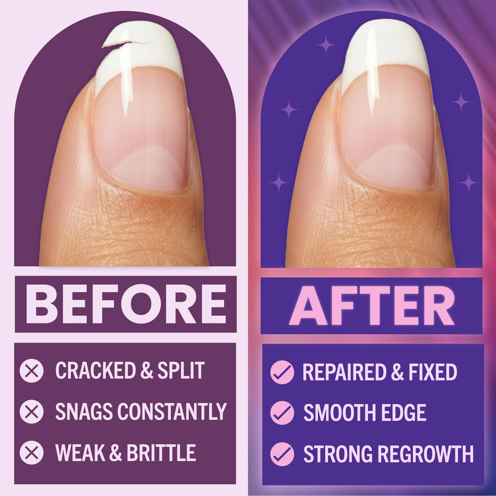 Finga-Nails repair glue nozzle detail for precise application