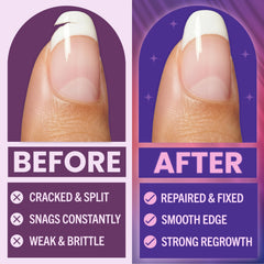 Finga-Nails repair glue nozzle detail for precise application