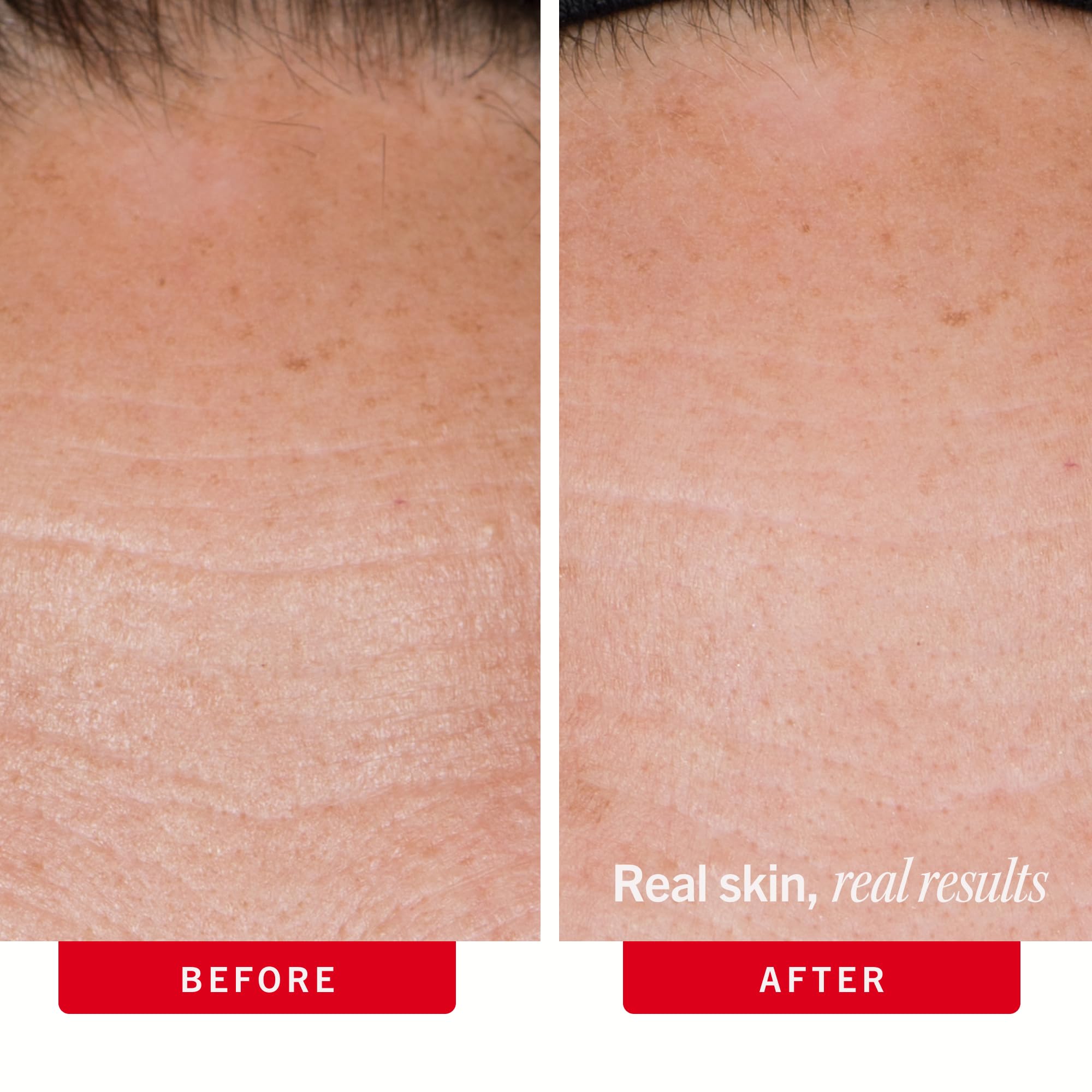 First Aid Beauty cream applied to jawline and neck for visible firming effect