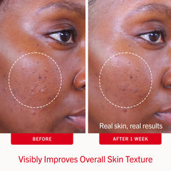 First Aid Beauty pad soaked in solution highlighting consistent salicylic delivery