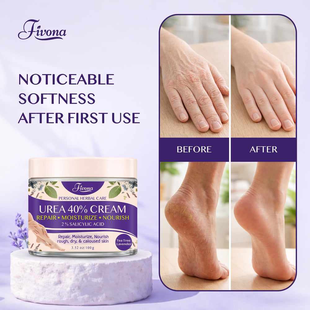 FIVONA before and after callus improvement showing visible smoothing