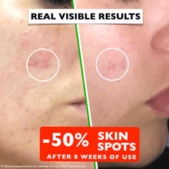 Florence application dropper dispensing serum for precise, controlled use