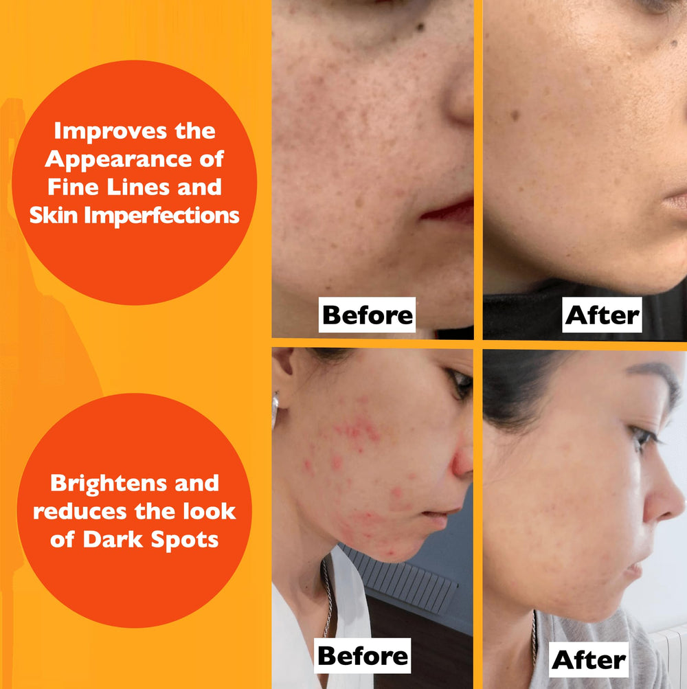 Florence bottle in hand for size and scale with easy-to-use packaging