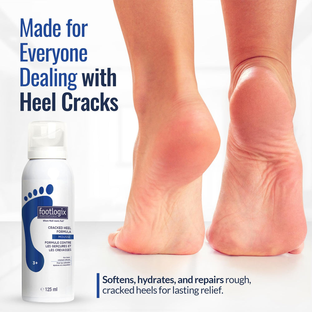 FOOTLOGIX bottle next to hand showing 4.23 oz scale and portability