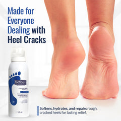 FOOTLOGIX bottle next to hand showing 4.23 oz scale and portability