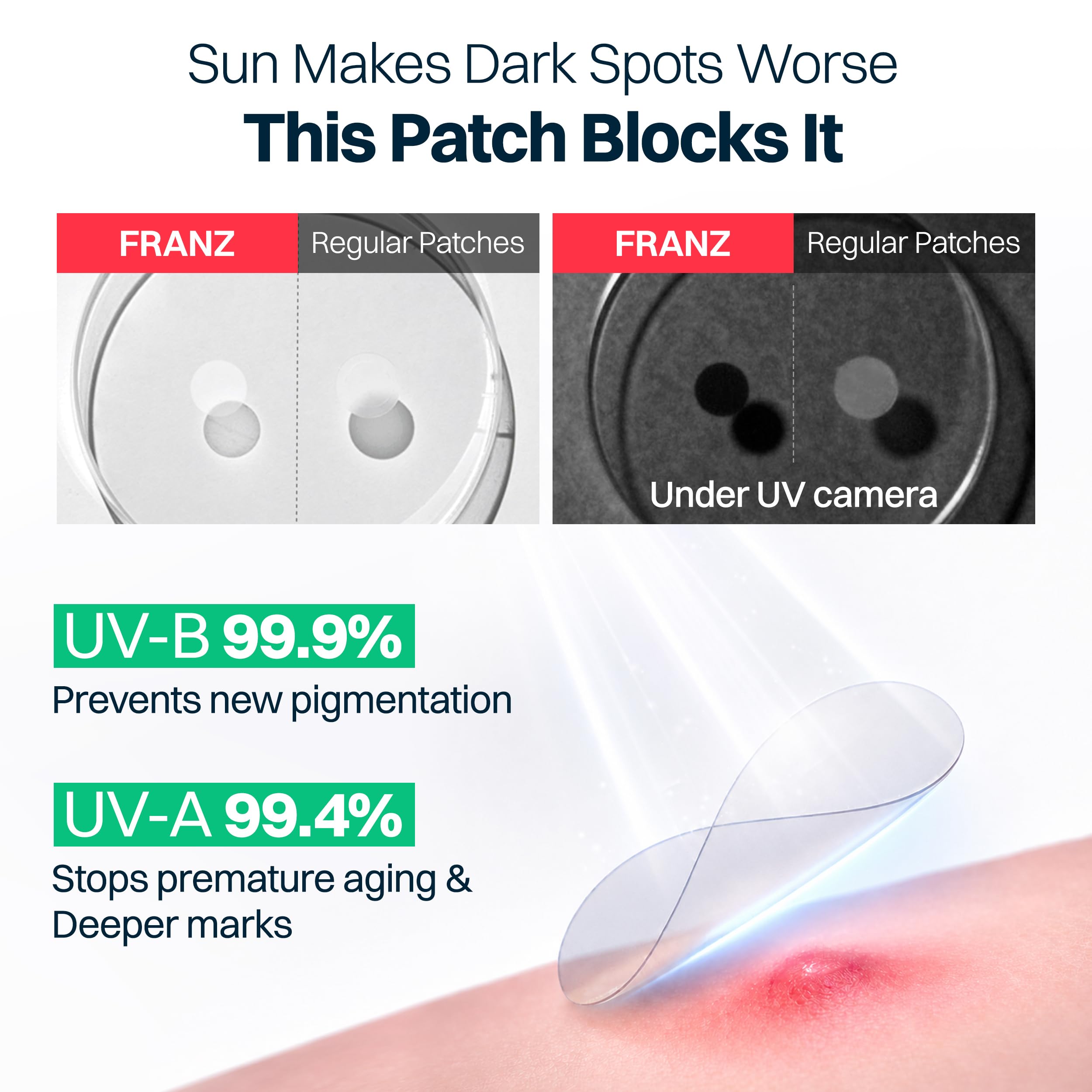 FRANZ pack opened to show 72 patches for extended post-breakout care