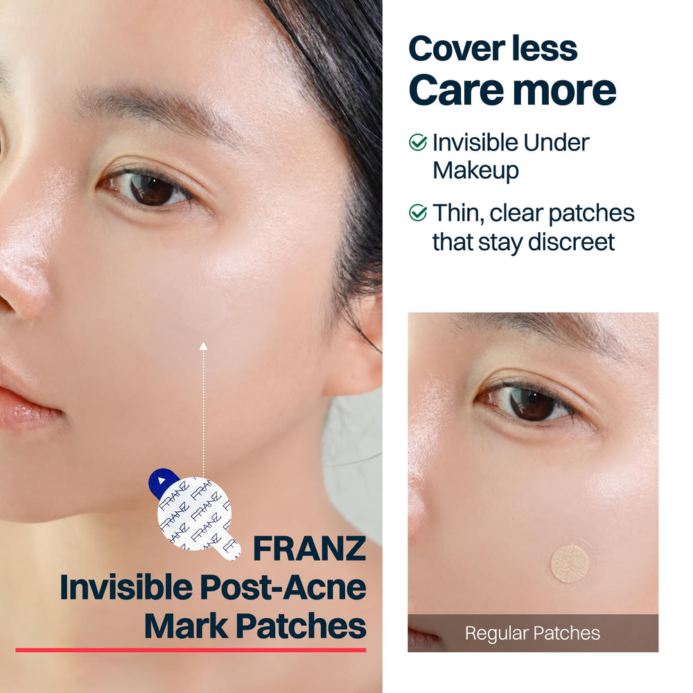 FRANZ patch under foundation showing makeup-friendly concealment and confidence