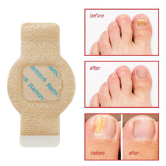 Frovetani lifestyle shot on bedside table showing convenient overnight nail care routine