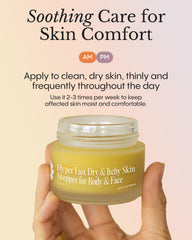 FRØYA balm being applied on hand, demonstrates quick relief and protective layer