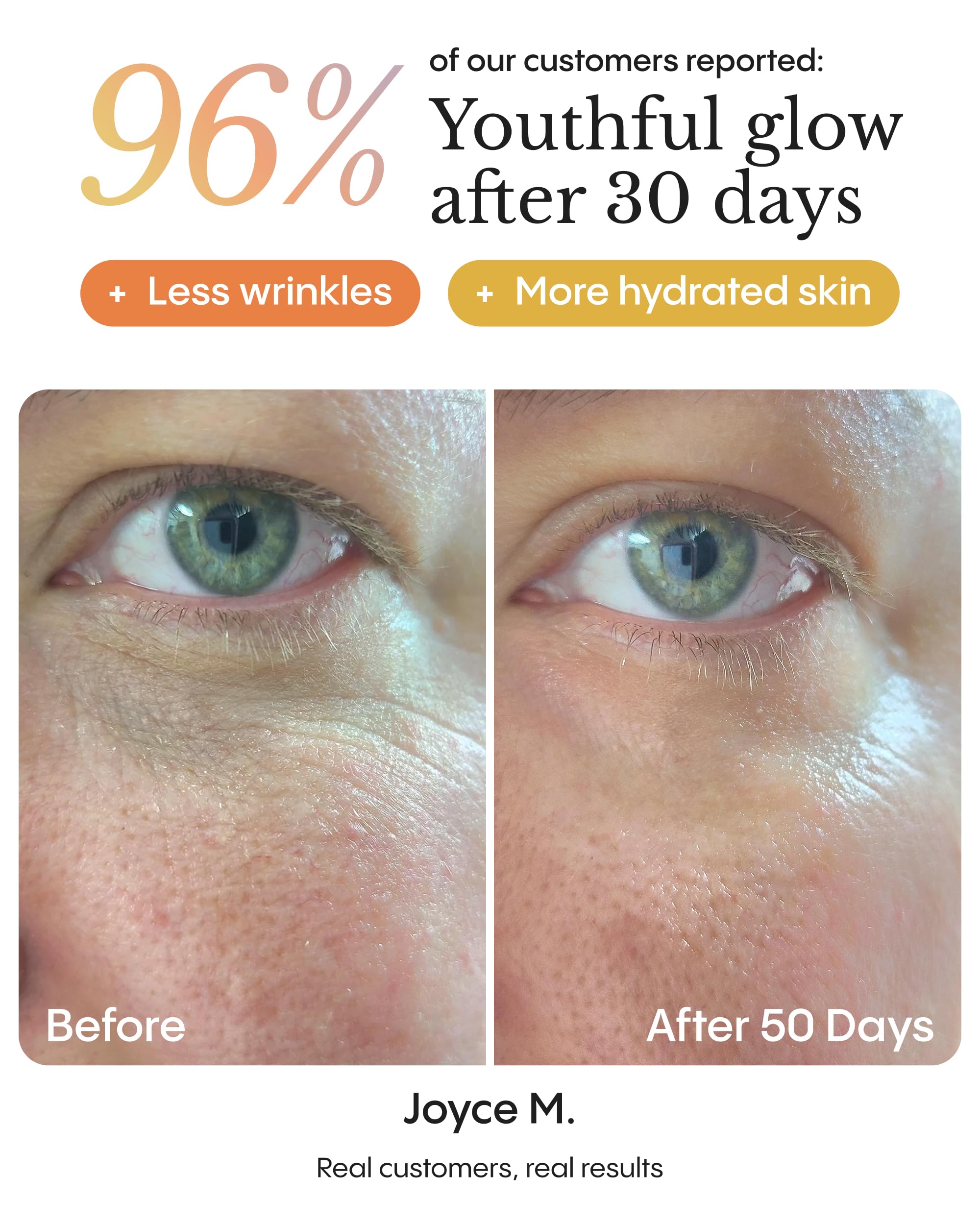 FRØYA application on fingertip demonstrating easy-to-spread balm and gentle finish