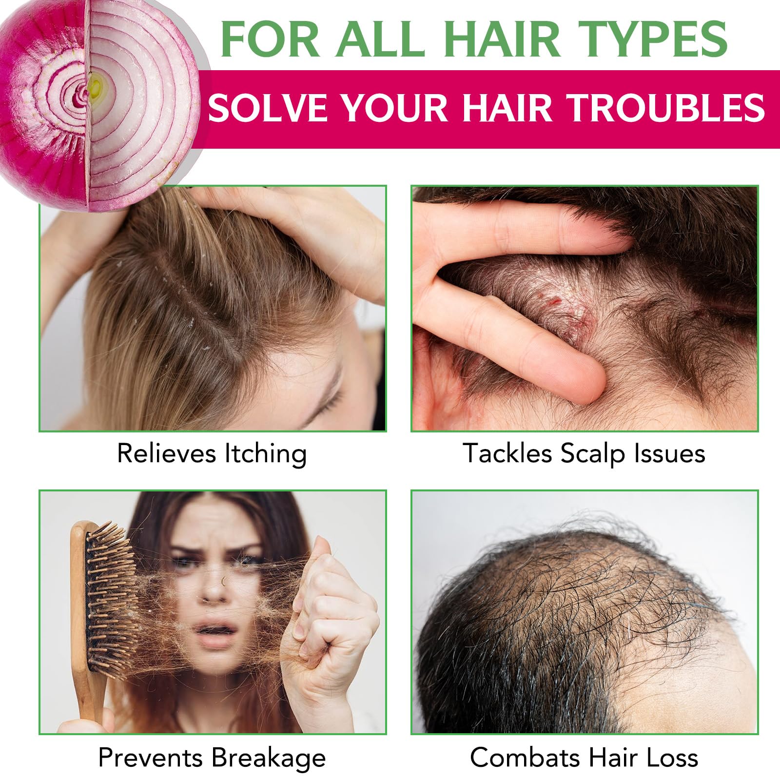 FSLHCY label close-up highlighting onion, rosemary, and biotin ingredients and clarity