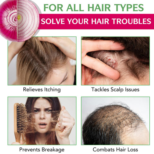 FSLHCY label close-up highlighting onion, rosemary, and biotin ingredients and clarity