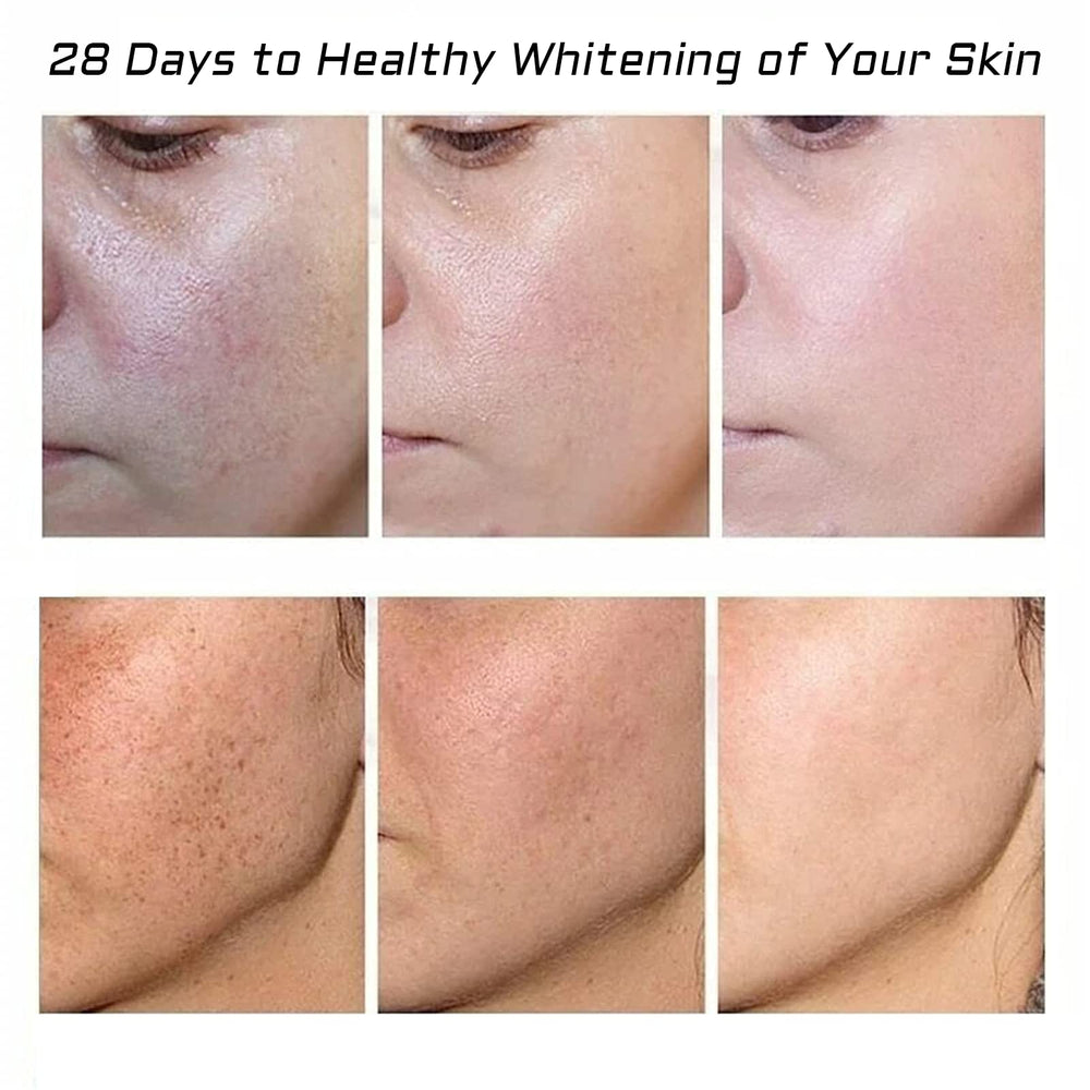 fupah cream on finger ready for application benefits precise targeted spot treatment