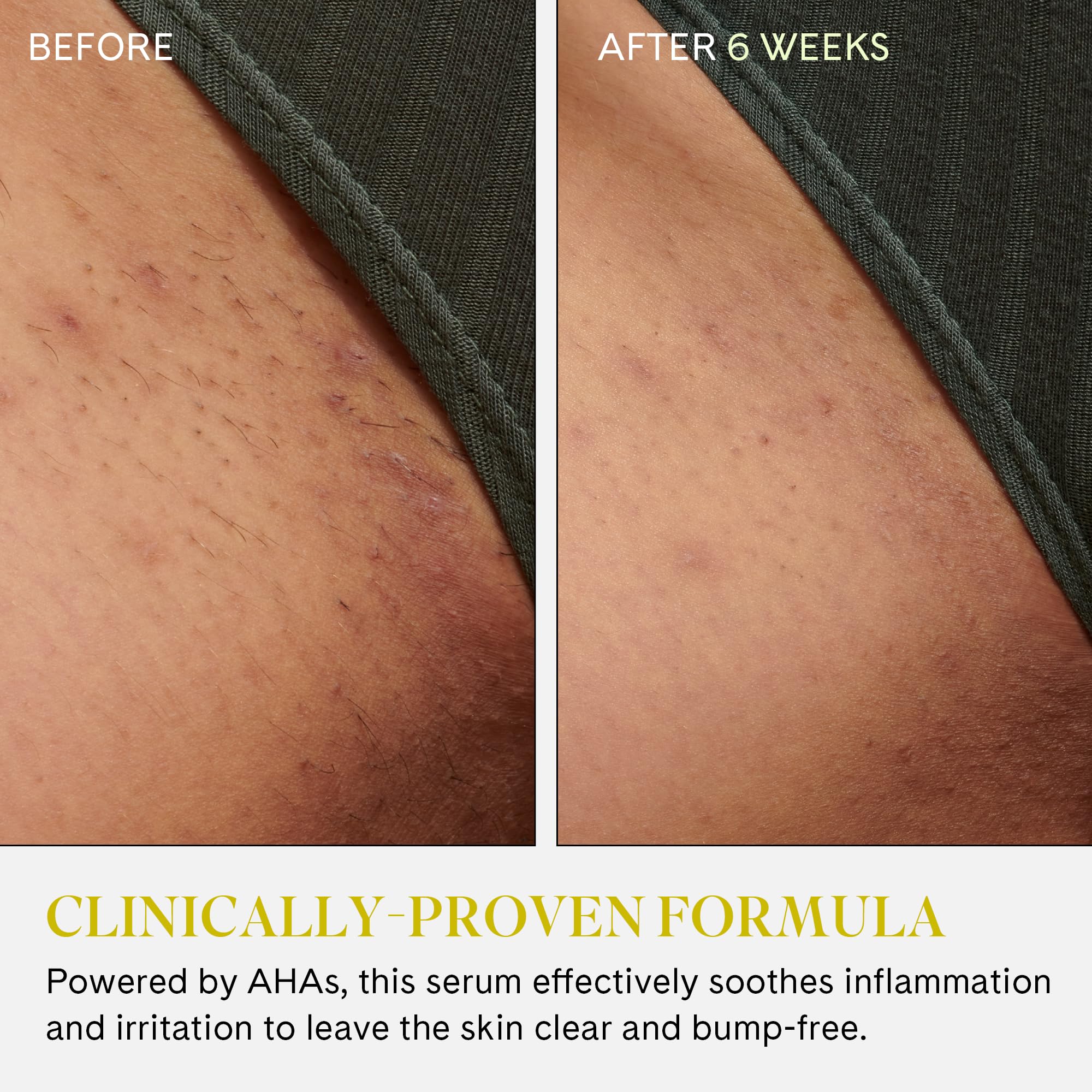 Fur rollerball rolling onto underarm skin to soothe irritation and reduce bumps