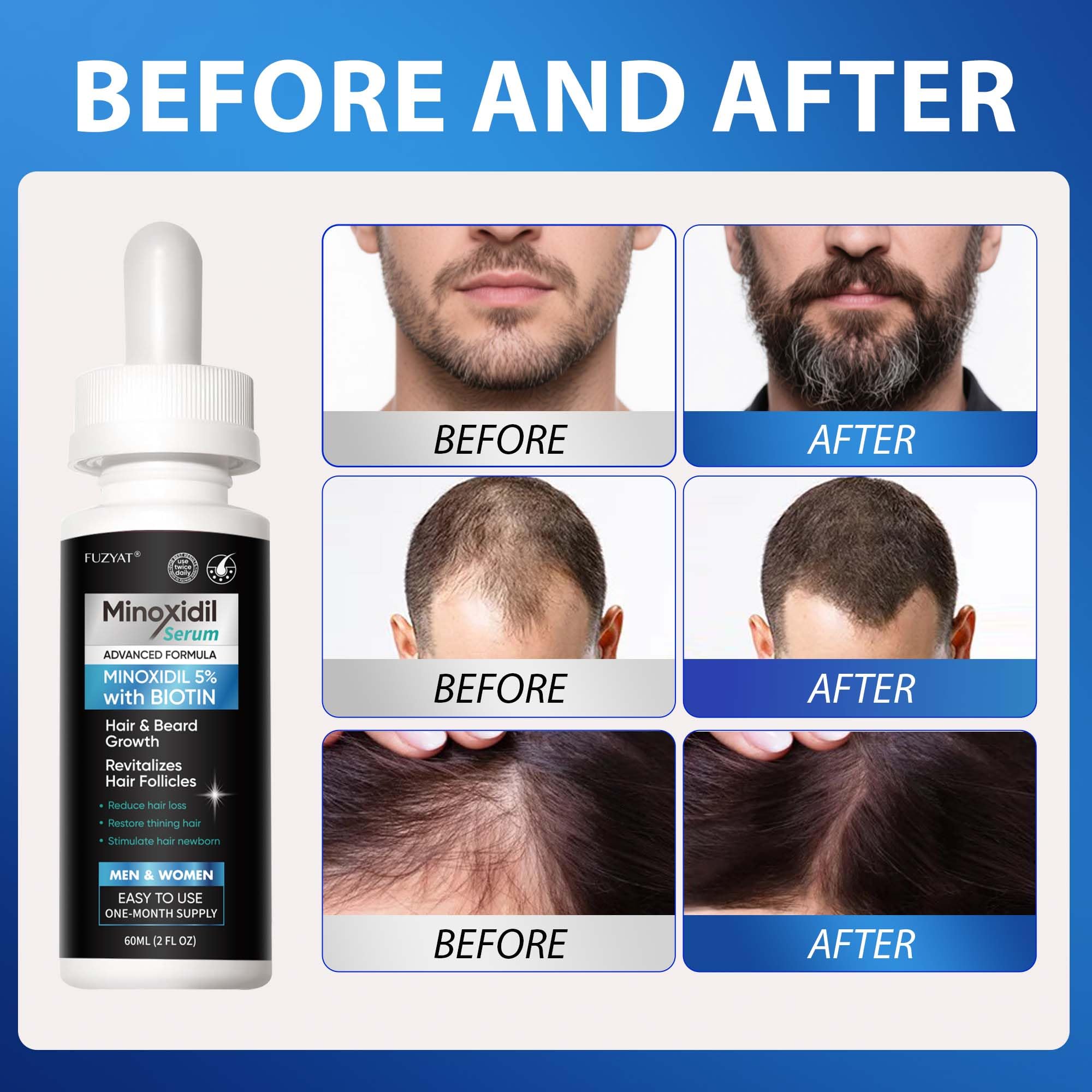 FUZYAT beard application demonstration illustrating targeted use to support fuller facial hair