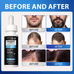 FUZYAT beard application demonstration illustrating targeted use to support fuller facial hair