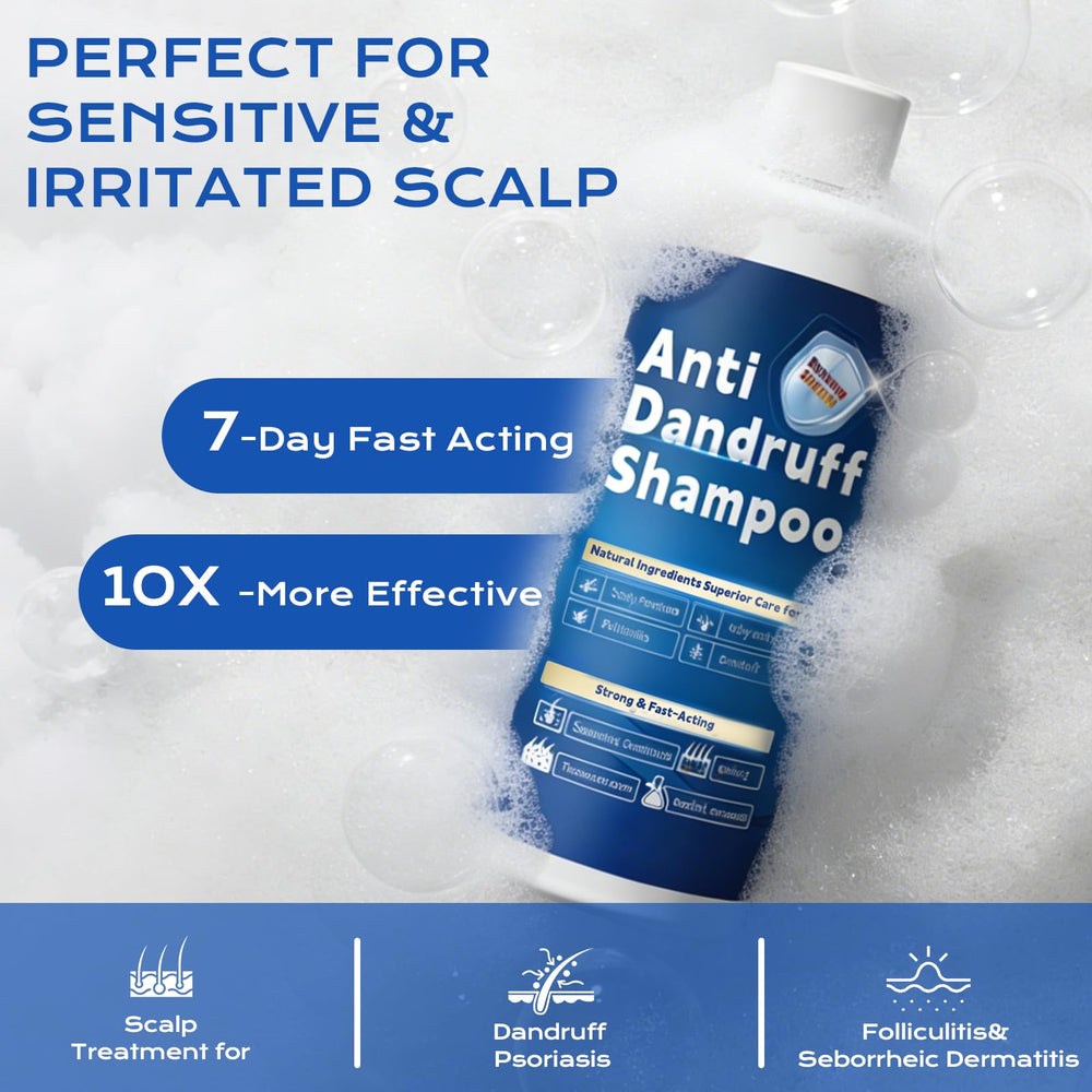 FYZMTL label close-up highlighting 1% ketoconazole active ingredient