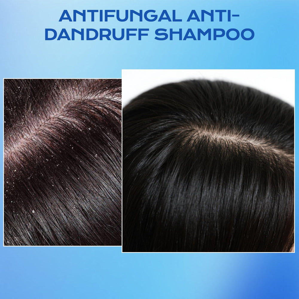 FYZMTL shampoo applied to scalp in hands illustrating targeted use