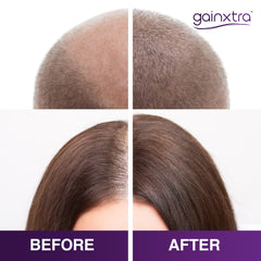 GAINXTRA spray on scalp demonstrating fast-absorbing, non-greasy texture