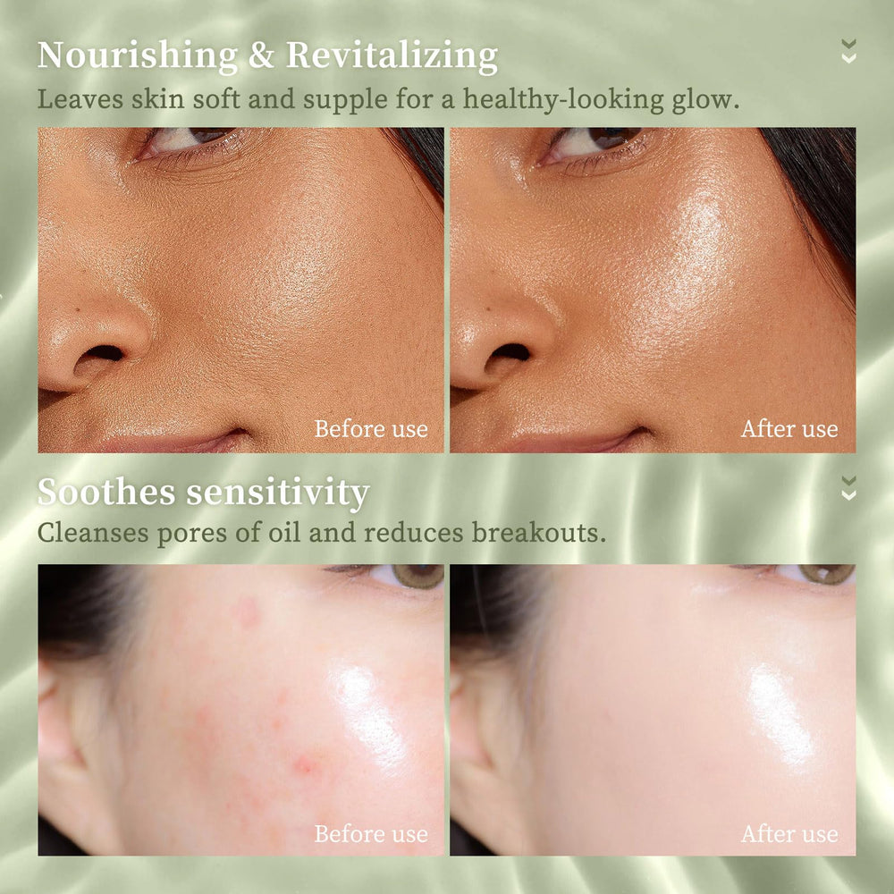 gcdat applying balm to shoulder for cooling hydration