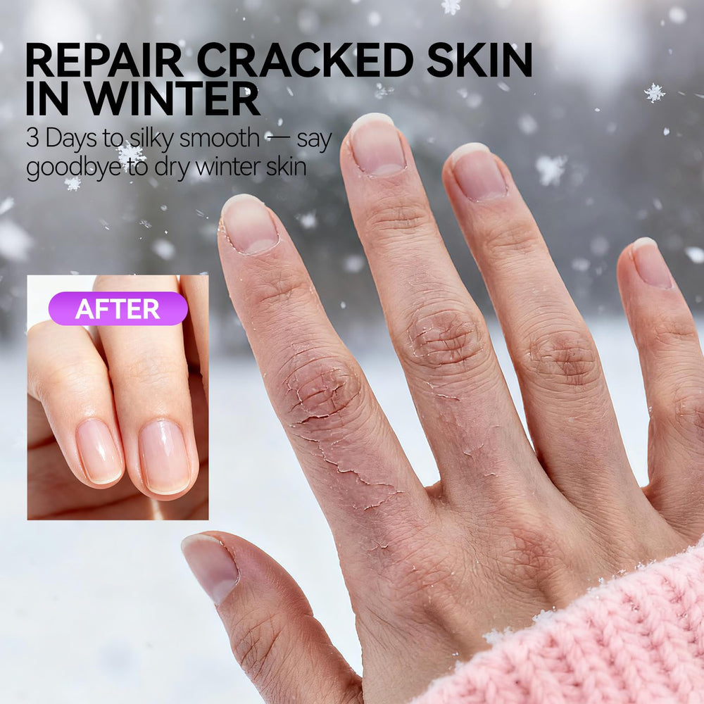 gelike ec cream applied to fingertips, softens cuticles for easier manicure
